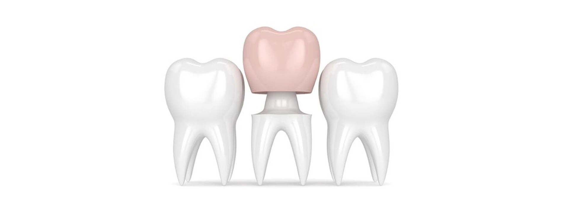 Dental Services in Chaitanyapuri